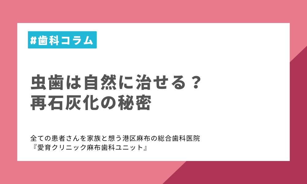 虫歯は自然に治せる？再石灰化の秘密